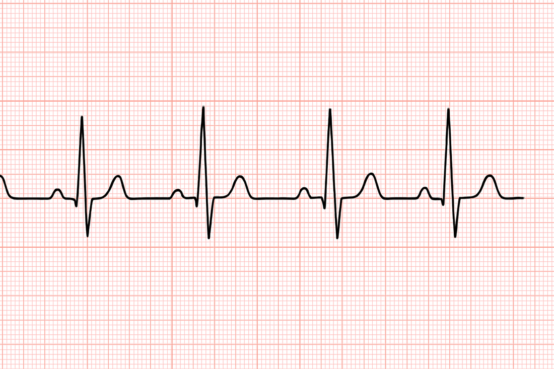 9/27/25 Session Recap: And the Roller Coaster Ride Continues