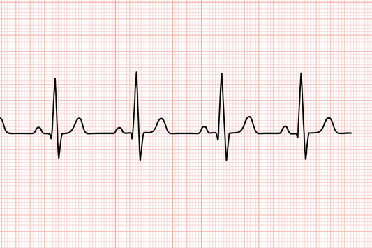 9/27/25 Session Recap: And the Roller Coaster Ride Continues